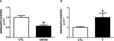 ARHGAP21 Acts as an Inhibitor of the Glucose-Stimulated Insulin Secretion Process